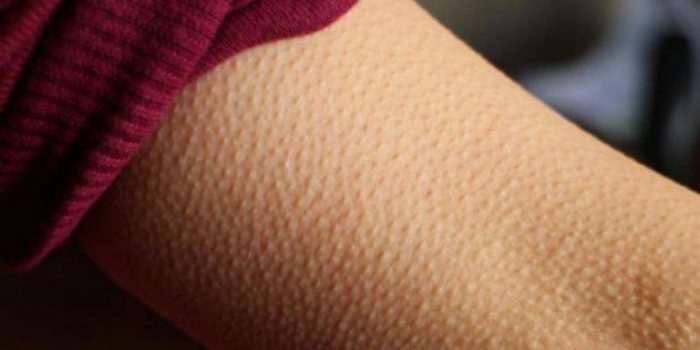 If Music Gives You Goosebumps Your Brain Might Be Special, According To Science