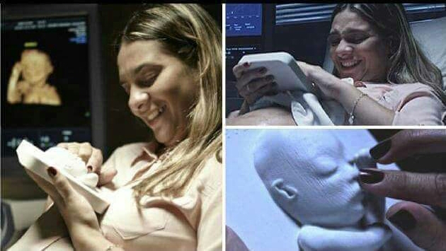 Doctors Made A 3D Print Of An Ultrasound For A Blind Expecting Mama