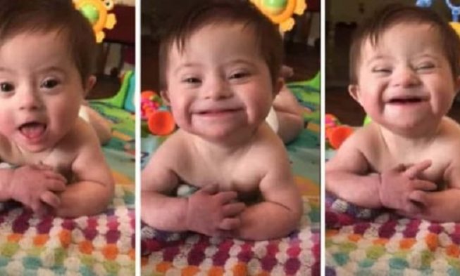Baby With Down Syndrome Is Loved By Millions After Showing Adoptive Mom Her ‘New Smile’
