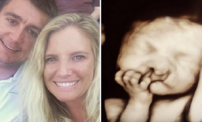 Parents Refuse to ABORT Their ‘Deformed’ Baby — Just Look at Him 2 Years Later