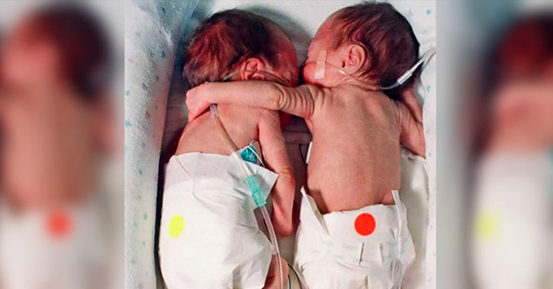 Nurse Places Dying Newborn next To Her Twin, Ends up Giving Her a Hug That Saves Her Life
