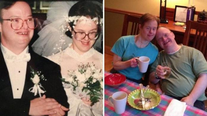 ‘World’s Longest Down Syndrome Marriage’ Ends After 25 Years As Husband Dies