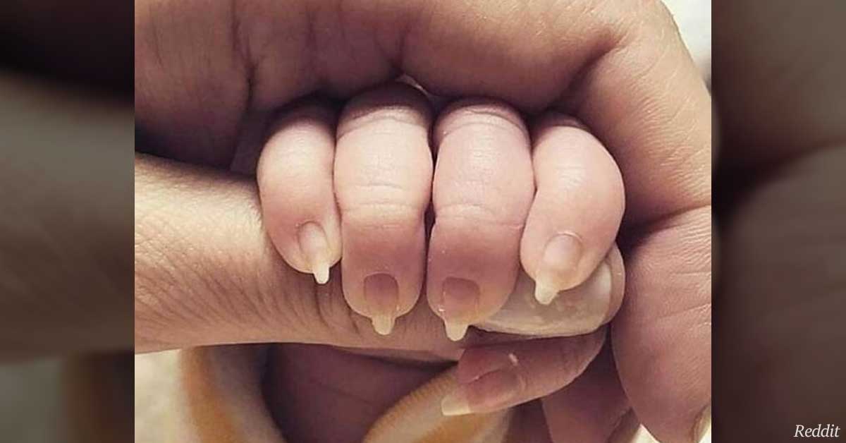 Mother Accused Of ‘Child Abuse’ After Sharing Photo Of Her Baby’s Creepy Fingernails