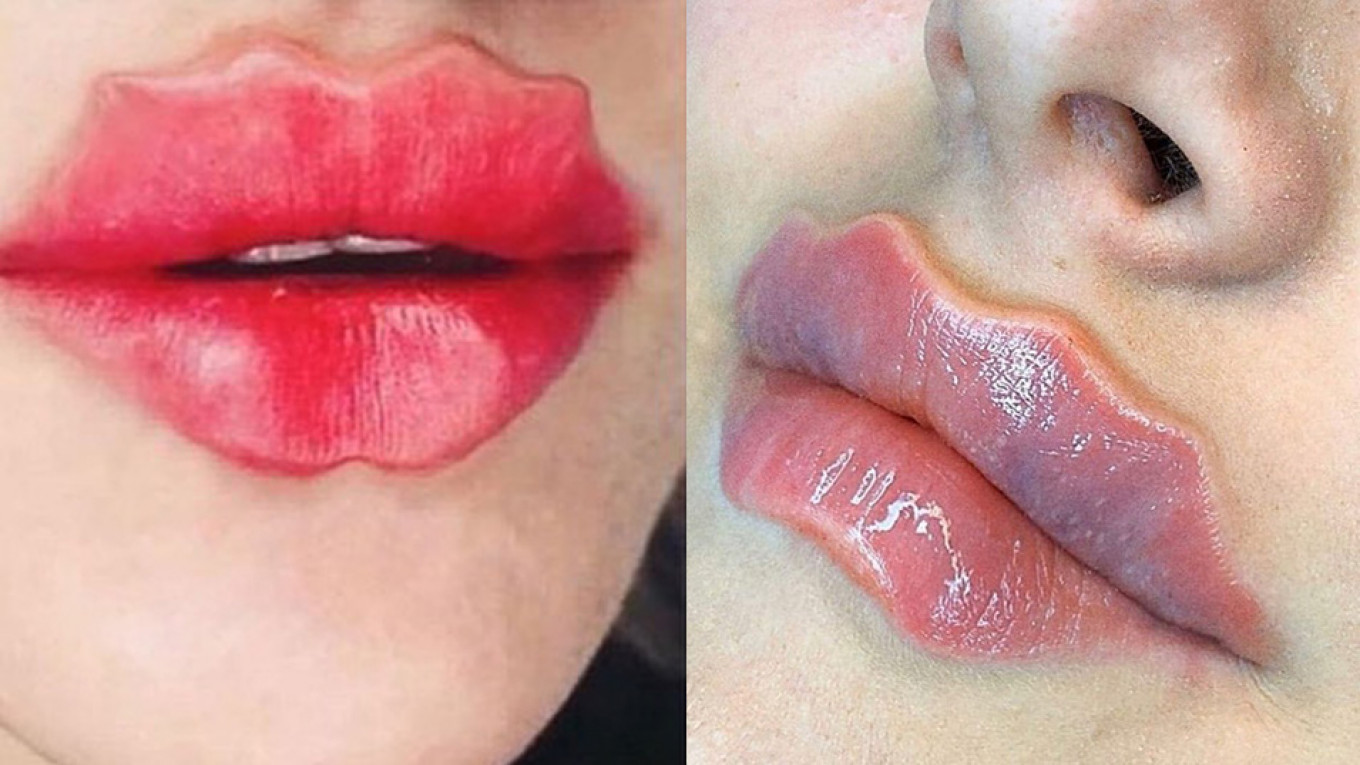 Wavy Lips: The Odd Beauty Trend That Took Over Social Media