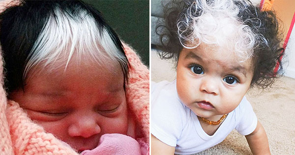 Little Girl Born With A White Patch Of Hair Which Is Exactly The Same As Her Mum’s