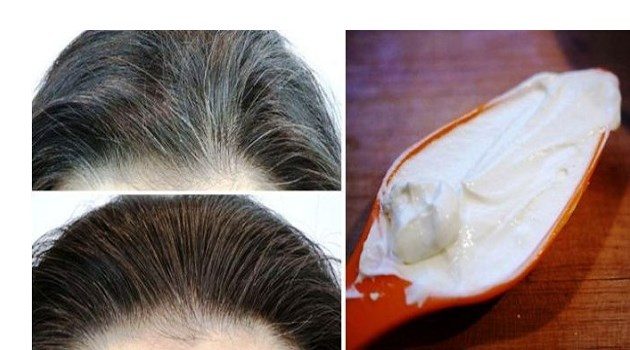 Want to Get Rid of Your Early White – Gray Hair for Good? There Is a Way
