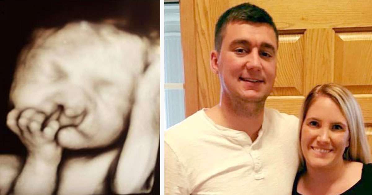 Parents Who Wouldn’t Abort “Deformed” Baby, Show That Love Really Can Conquer All