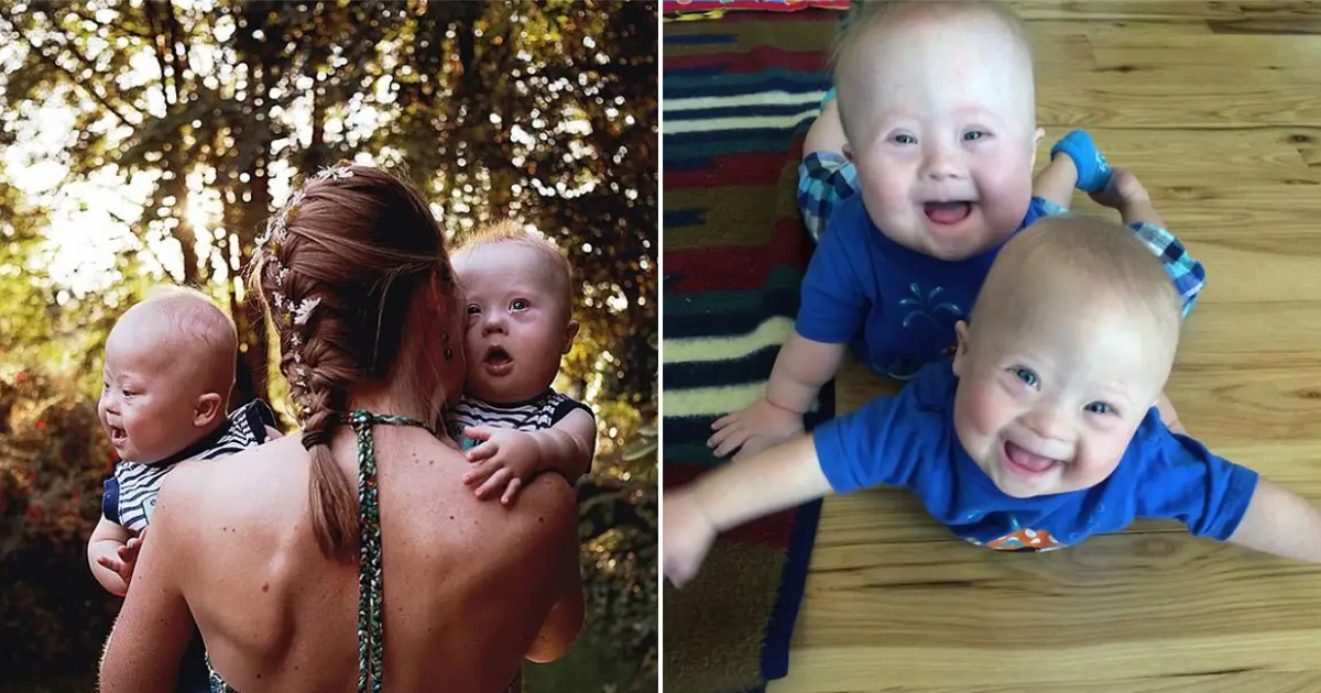 Mom Finding Out Twin Have Down Syndrome, Tries To Put Them For Adoption But Changes Her Mind In Third Trimester