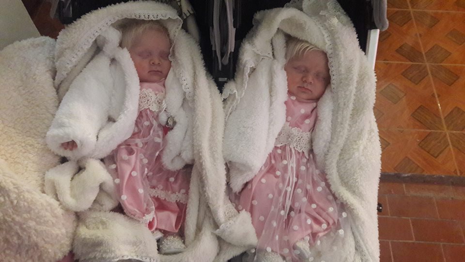 Mom Gives Birth to Rare Albino Twins With Snow White Hair
