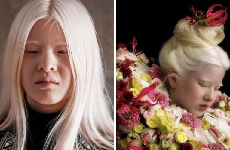 Abandoned By Parents, She Vowed To Prove Them Wrong – Today, She Models For Vogue