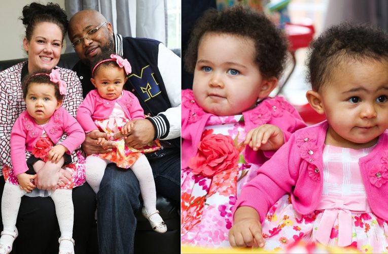Sisters Who Looked Almost Identical at Birth Grow Up to Have Different Skin Colors