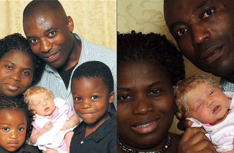 10 Years Ago, Snow White Baby Was Born In A Black Family, What Does The Girl Look Like Now?
