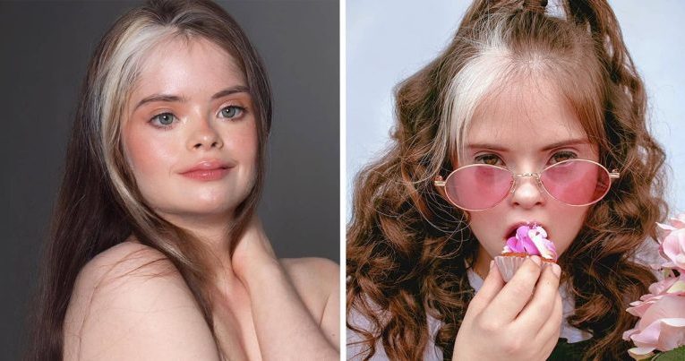Jessica, a Model With Down Syndrome, Shows That You Are The Only One Who Can Define What Beauty Is