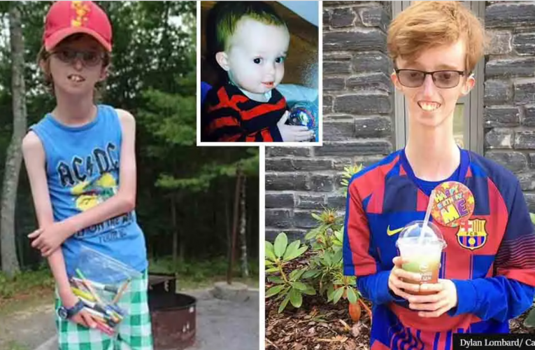 Teenager Has Rare Condition That Means He Can’t Store Fat And Will Never Put On Weight