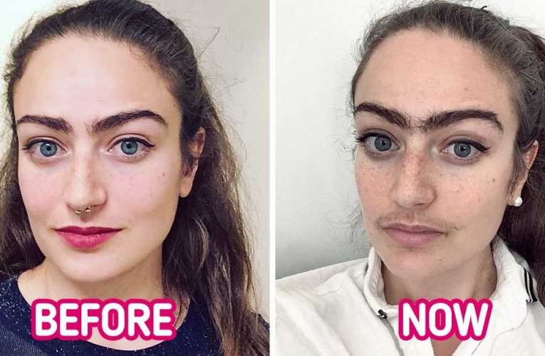 Woman Who Stopped Removing Facial Hair Shares How the Decision Changed Her Life