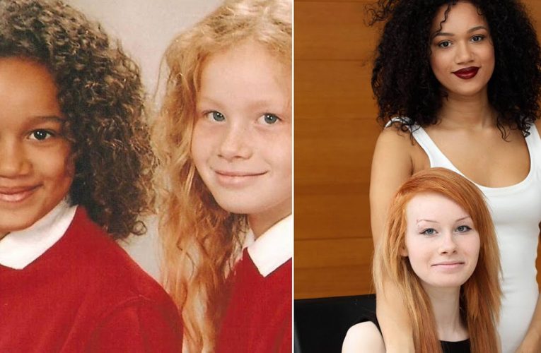 Twin Girls Born with Different Skin Colors Grow Into Beautiful Women