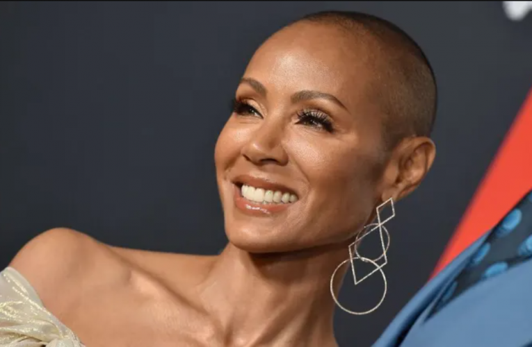 Here’s What 5 People With Alopecia Think About That Chris Rock Joke