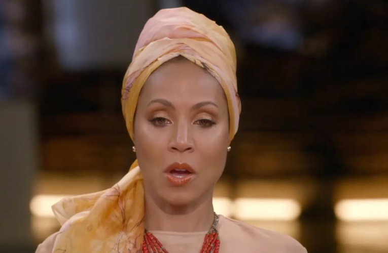 Women With Alopecia Say They Felt Jada’s Pain Over Chris Rock’s Joke at the Oscars