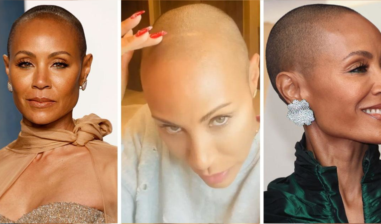 Jada Pinkett Smith’s Alopecia Left Her ‘Shaking With Fear’ At First But Today She Is ‘Friends’ With It