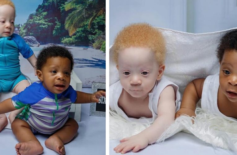 Mom Sets The Record Straight: Her ‘Black & White’ Baby Boys Are Identical Twins