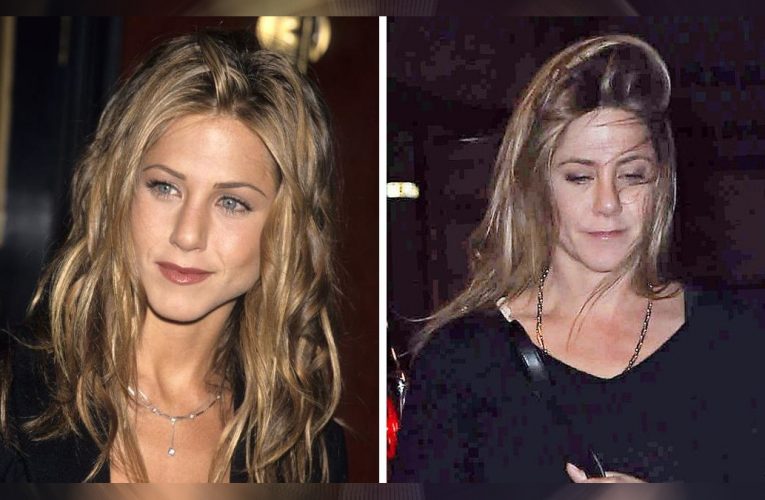 Jennifer Aniston’s ‘Heart Breaks’ For Women Who Turn To Plastic Surgery To Address Their Insecurities