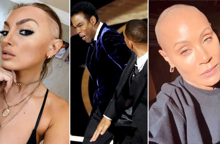 Alopecia Advocate Praises Will Smith For Supporting His Wife Over Chris Rock’s Joke