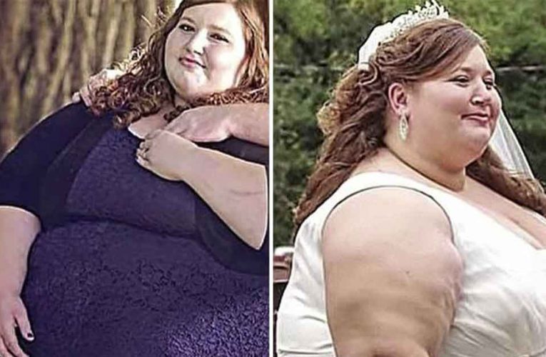 The Internet Is Going Crazy Over The Girl That Lost Over 300lbs and Her Astonishing Transformation
