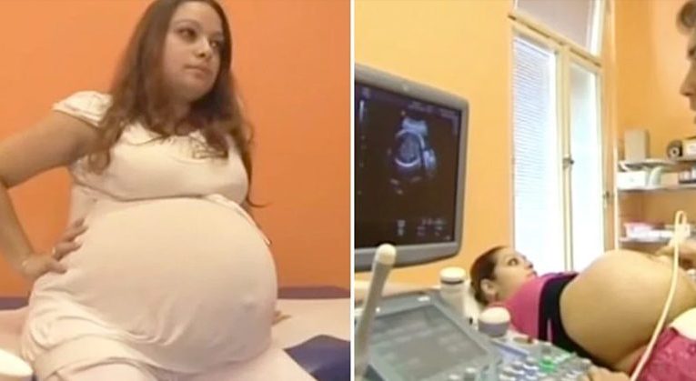 23-Year Old Mother Made History With A Birth That Only Happens Every 480 Years