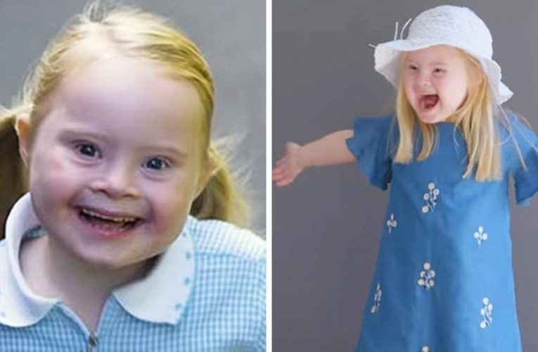 Young Girl With Down Syndrome And Wonderful Smile Becomes Successful Model