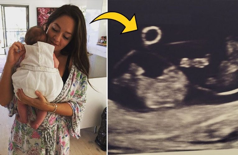 Mom Felt Weird 6 Weeks After Giving Birth So Went Back To Doctor And Took Ultrasound Scan