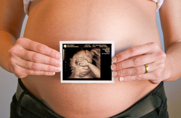 Pregnant Woman Goes for an Ultrasound, Doctor Gets Quiet When He See the Baby Is Not Alone There