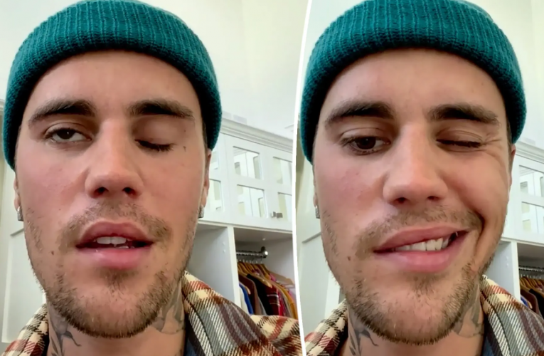 Justin Bieber’s Face Paralyzed After Being Diagnosed With Rare Disorder