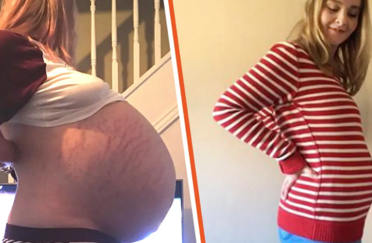 Woman Who Looks Nine Months Pregnant Does an Ultrasound and Finds Out She’s Not Pregnant