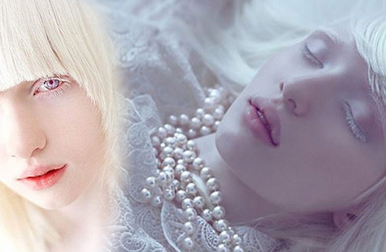 18-year-old Albino Ukrainian Model Is Known As ‘The Most Beautiful Angel’ And Netizens Are In Awe With Her Unrivalled Beauty!