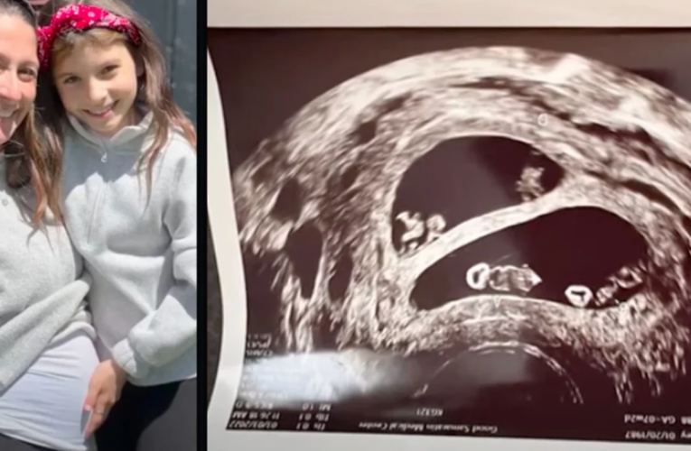 Mom Who Lost 4 Babies Discovers She’s Pregnant With 2 Sets of Identical Twins
