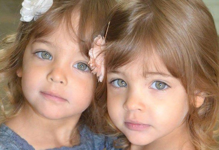 Identical Sister Born In 2010, Have Grown Up To Become Most Beautiful Twins In The World