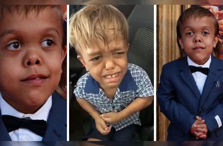 Bullied For His Dwarfism, Quaden Bayles Is Now A Red Carpet Star